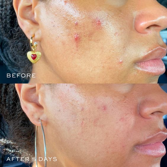 Spot The Difference Blemish Treatment - Traitement Anti-Imperfections [15ml] - AXIS - Y - Beauty Care